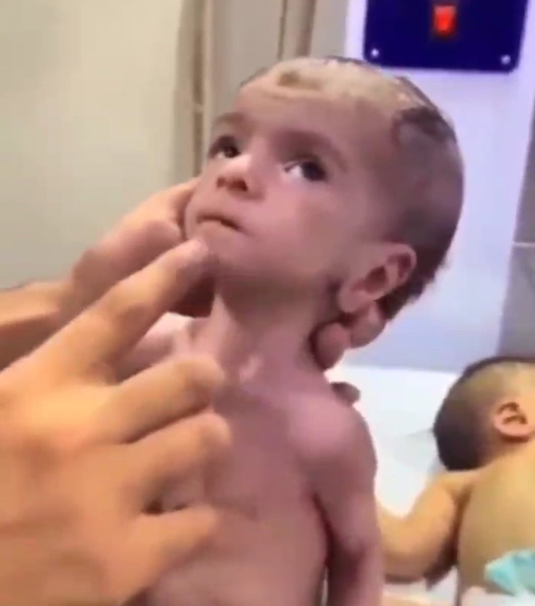 Emma22888072's tweet image. Palestinian babies are dying of starvation
This news should be on the headlines of the world's newspapers