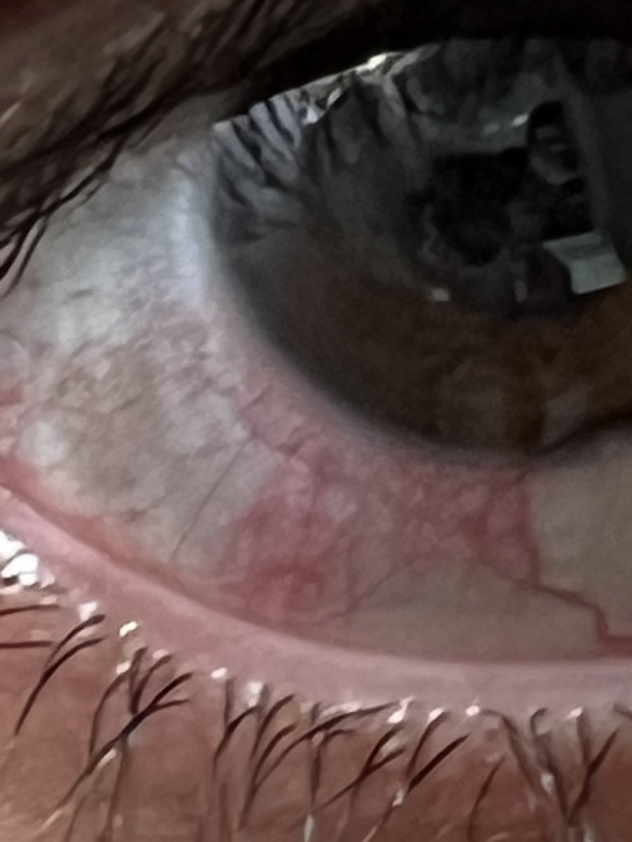 یادش بخیر، اینو وقتی گرفتم که دقیقا روزی یه فصل GOT میدیدم.