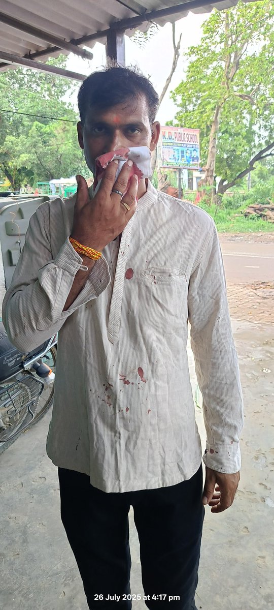 saidpurbar's tweet photo. @ghazipurpolice @IgRangeVaranasi @Uppolice
महोदय, तहसील सैदपुर के अधिवक्ता अखिलेश सिंह के साथ अंतर्गत धारा 304 (1), 115 (1), 352, 351 (3) भारतीय न्याय संहिता की आपराधिक घटना हुई है।  यह थाना खानपुर में अधिवक्तागण प्रार्थना लेकर बैठे हुए हैं लेकिन प्राथमिकी दर्ज नहीं की जा रही है https://t.co/S5MFQZ5xLs
