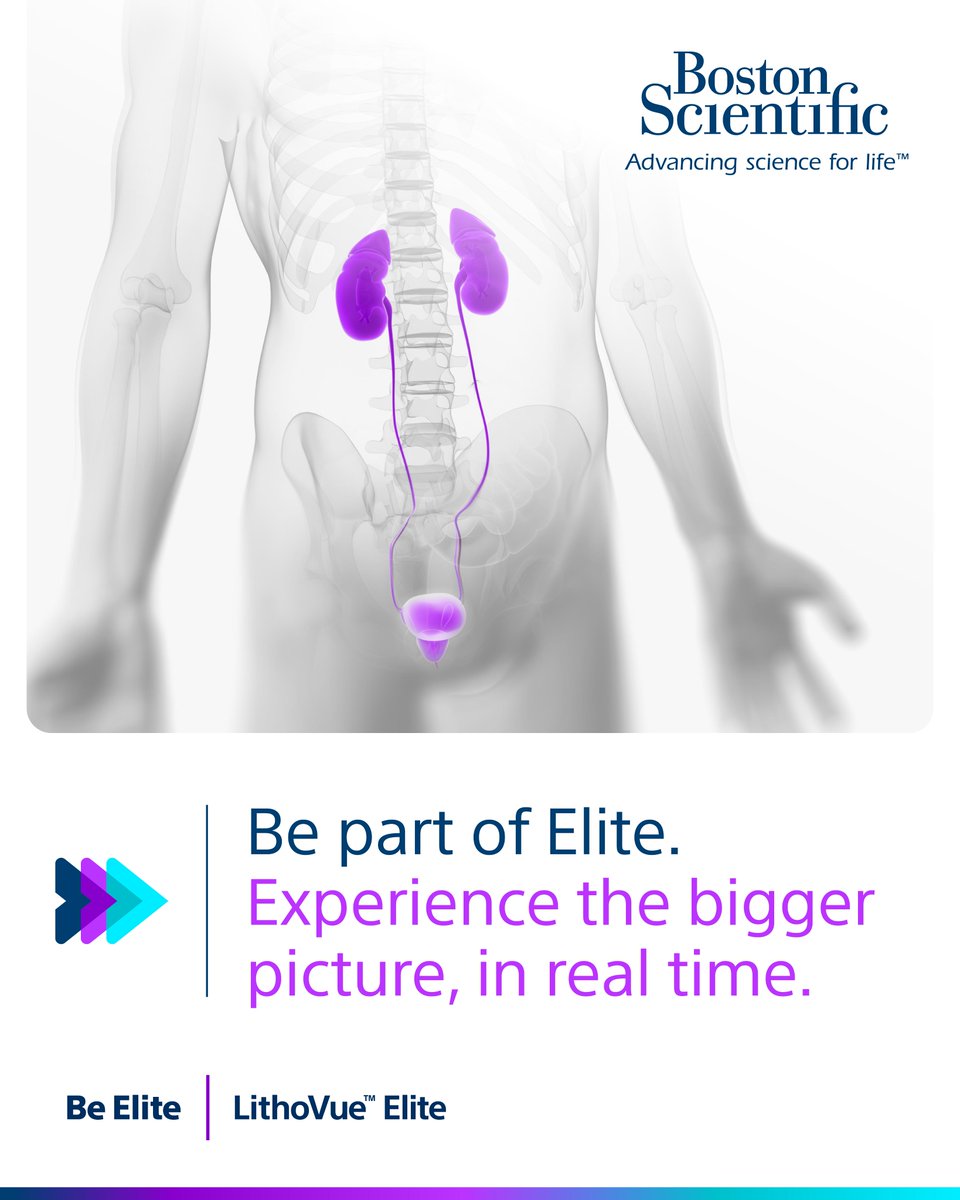 Would you like to experience the future of ureteroscopy technology?

It is right here with the LithoVue™️ Elite ureteroscope, which allows you to monitor real-time #intrarenalpressure data.

Learn more: bit.ly/4lhk6Tf
 
#BSCEMEA #BeElite #Endourology
