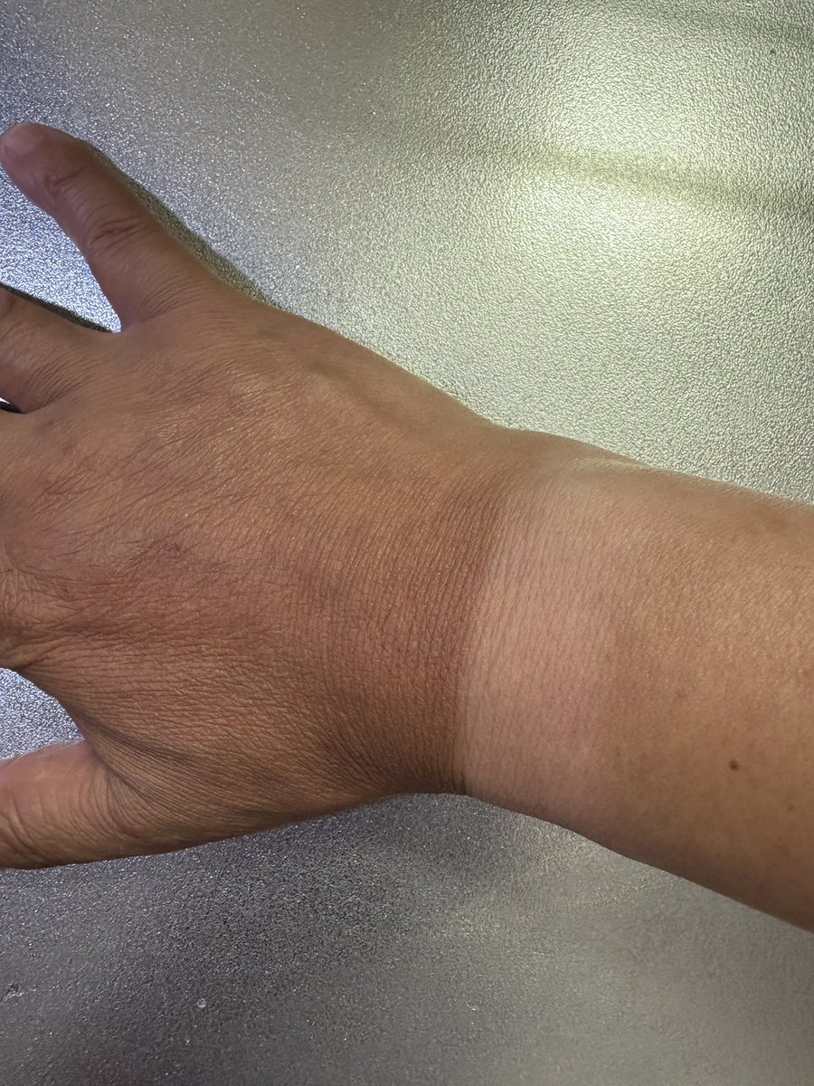 日焼け対策完璧すぎる。

何の問題もない‼️