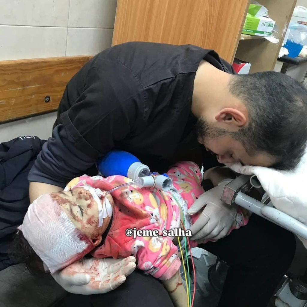 MostafaBNaim1's tweet image. This is a photo of my colleague Omar...
A photo that sums up the entire tragedy 💔
Taken inside Al-Shifa Hospital…
An exhausted doctor cradling a blood-soaked child,
amid crushing conditions that are draining our medical teams — physically and emotionally.
The injuries keep…