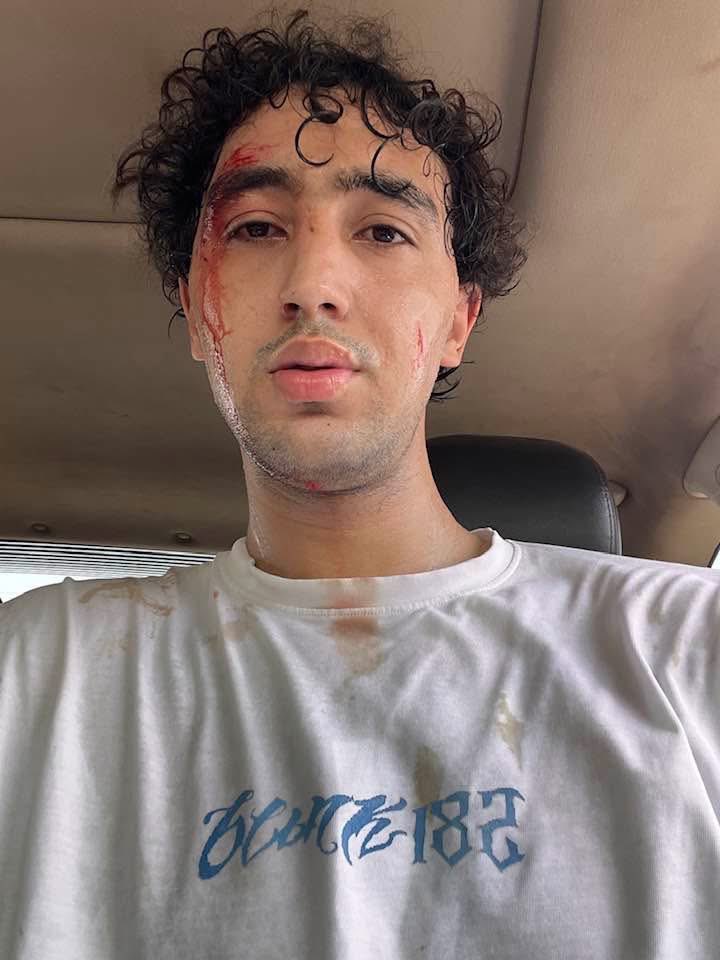 mohamed_zaki14's tweet image. أحمد رفاعي مدافع الزمالك المنتقل حديثاً إلى غزل المحلة يتعرض لحادث سير