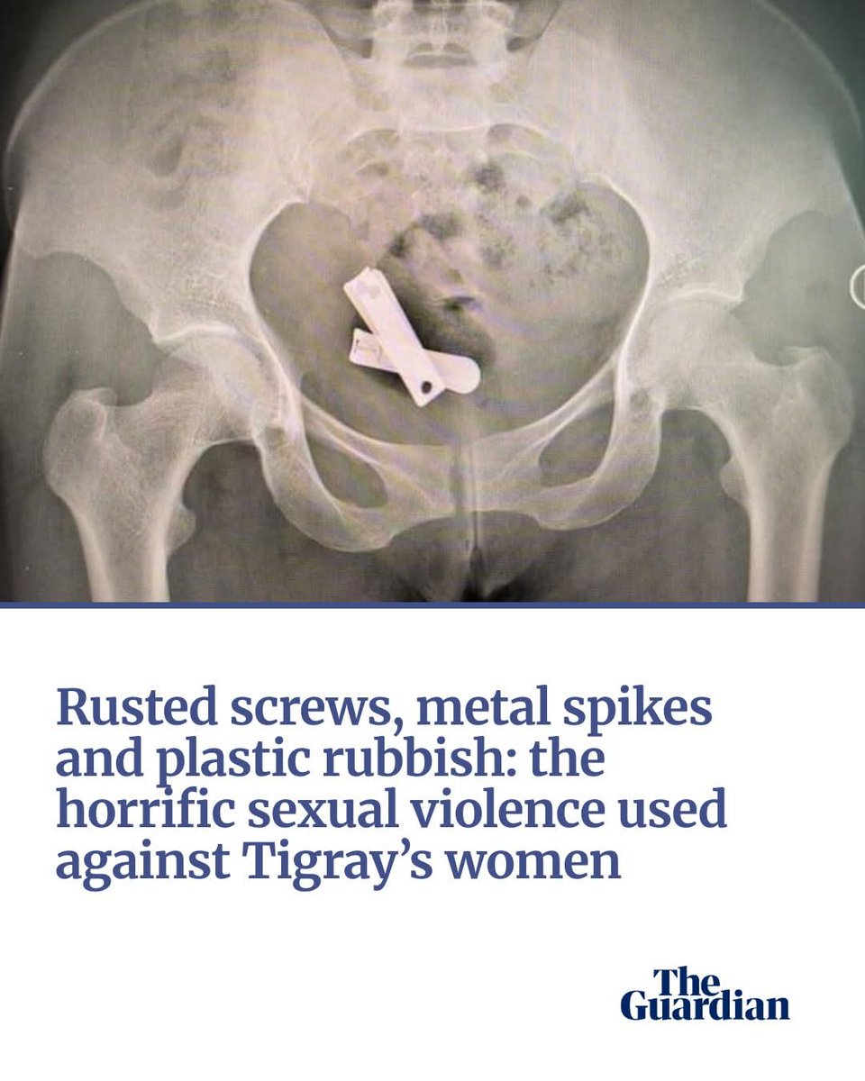 Brhane Negasi (@brhanene) on Twitter photo Tens of thousands of Tigrayan women report brutal wartime abuse by Ethiopian and Eritrean soldiers, such as gang-rape and the insertion of objects into their uteruses. But justice seems a distant prospect
#Justice4TigrayWomenAndgirls <a href="/NetflixFR/">Netflix France</a> <a href="/NetflixBrasil/">netflixbrasil</a> <a href="/NetflixUK/">Netflix UK & Ireland</a> <a href="/hulu/">Hulu</a> Tens of thousands of Tigrayan women report brutal wartime abuse by Ethiopian and Eritrean soldiers, such as gang-rape and the insertion of objects into their uteruses. But justice seems a distant prospect
#Justice4TigrayWomenAndgirls <a href="/NetflixFR/">Netflix France</a> <a href="/NetflixBrasil/">netflixbrasil</a> <a href="/NetflixUK/">Netflix UK & Ireland</a> <a href="/hulu/">Hulu</a>