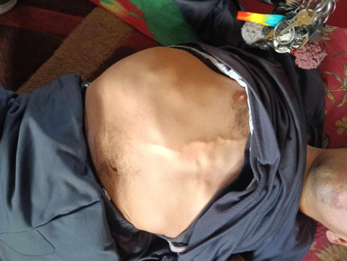 BASMA4019's tweet image. Look at my mother, what do you feed my brother Mohammed? A little rice is not enough for a small child
His health condition is constantly deteriorating and he has lost a lot of weight
Please help him
Donate or retweet
🔗steunactie.be/fundraiser/hel…