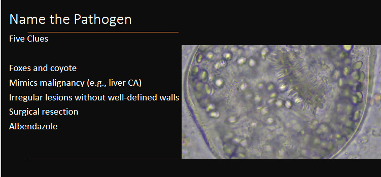 Weekend Digest

Name the Pathogen

Five Clues
1. Foxes and coyote
2. Mimics malignancy
3. Irregular lesions without well-defined walls
4. Surgical resection
5. Albendazole