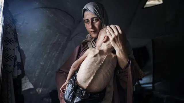 De la misma manera q repudió los actos terroristas perpetuados por Hamas y otros grupos extremistas contra el pueblo de Israel, condeno el silencio y la falta de acción del mundo ante la grave crisis humanitaria y la hambruna q están viviendo niños palestinos inocentes en Gaza