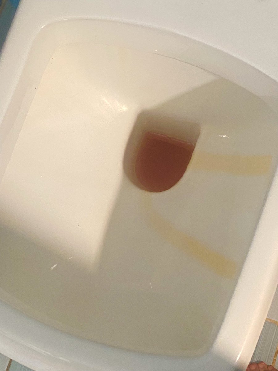 the_snoc_guy's tweet image. There’s no fucking way