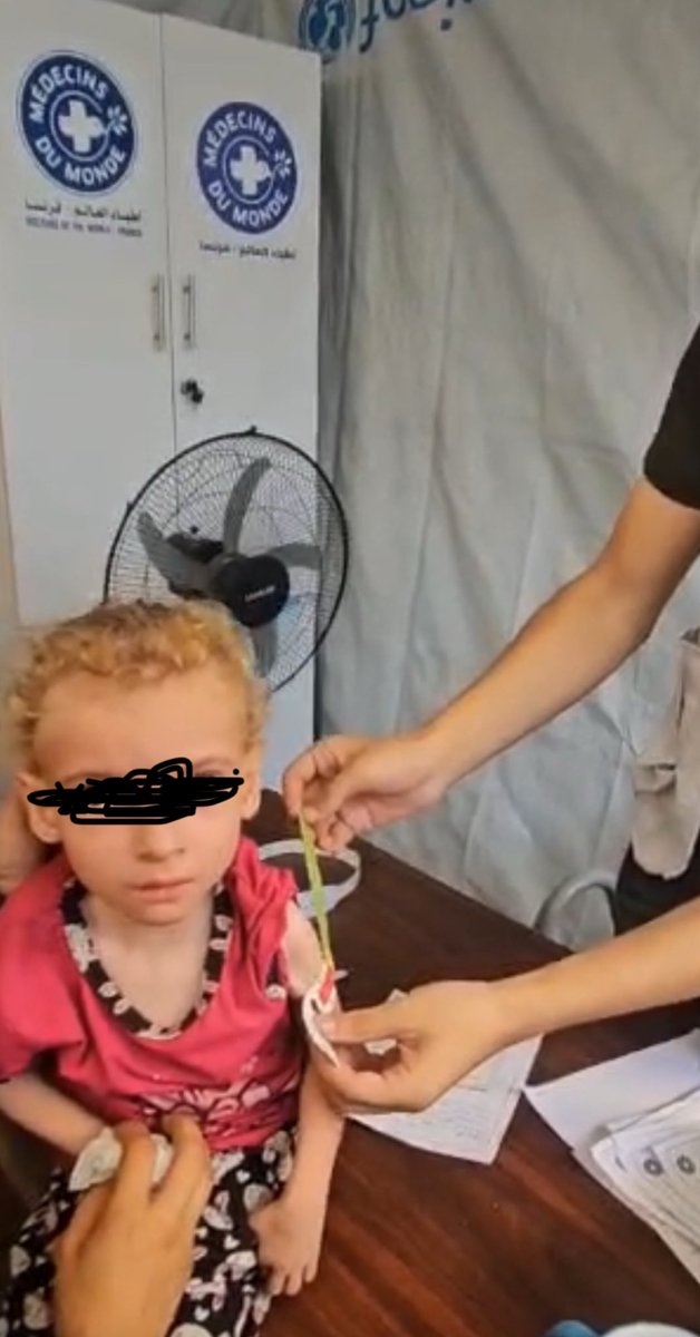 JfCorty's tweet image. #Gaza Les enfants décharnés à l’agonie à cause d’un siège d’allure génocidaire. Le monde doit se mobiliser contre cette barbarie @MdM_France