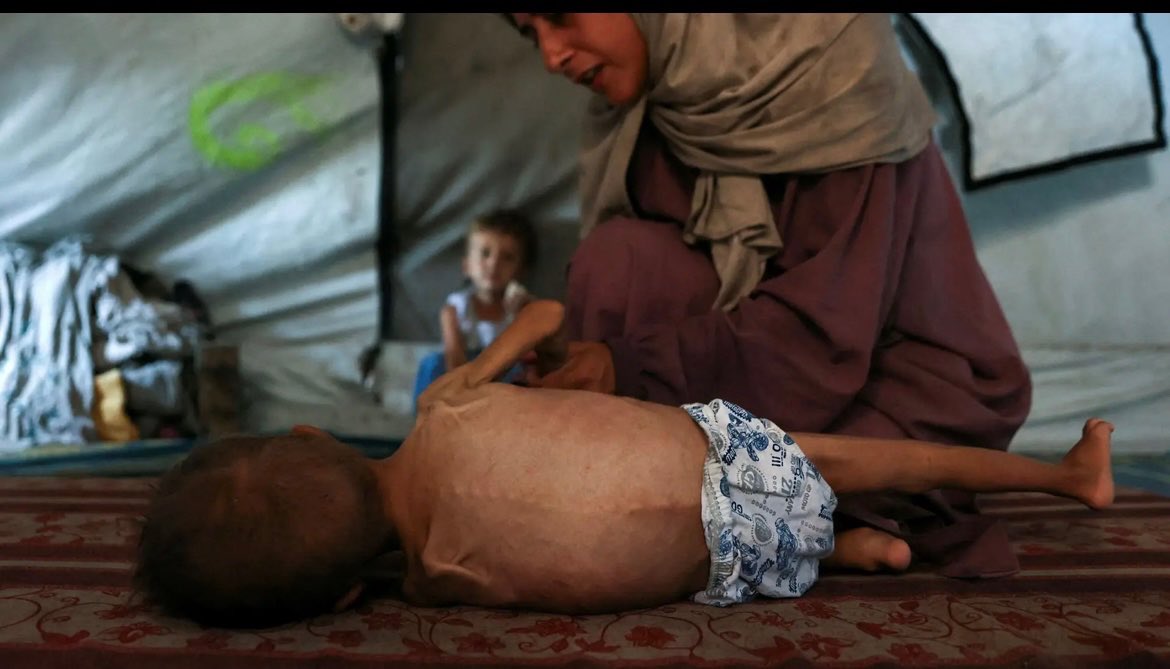 AtticusJazz's tweet image. Eine Mutter aus Gaza mit ihren ZWEI Kindern. Das eine Kind offensichtlich wegen Krankheit abgemagert, während das andere Kind völlig normal und gesund aussieht.
Die israelfeindlichen Medien verwenden allerdings nur das erste Bild, um die Lügengeschichte einer angeblichen…
