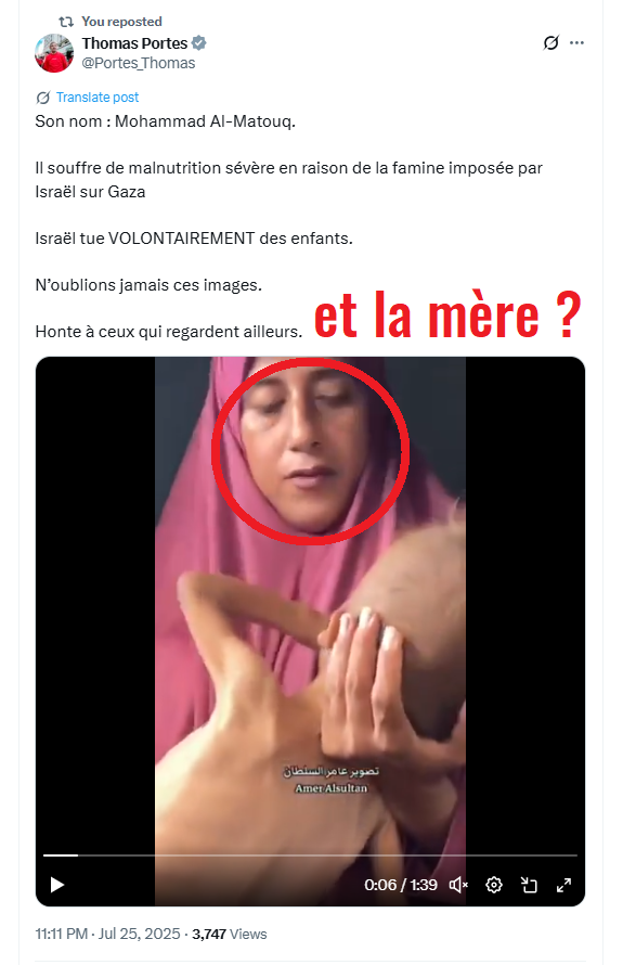 FrancoisAmara1's tweet image. PAS DE FAMINE A GAZA, LFI LE PROUVE
La famine ne touche pas un individu mais un groupe humain, sinon cela s'appelle une maladie.
Palis et propalis (1) en produisant de telles images apportent 2 preuves :
👉 la famine n'existe pas à Gaza,
👉 QI inférieur à 50, déficience sévère à…