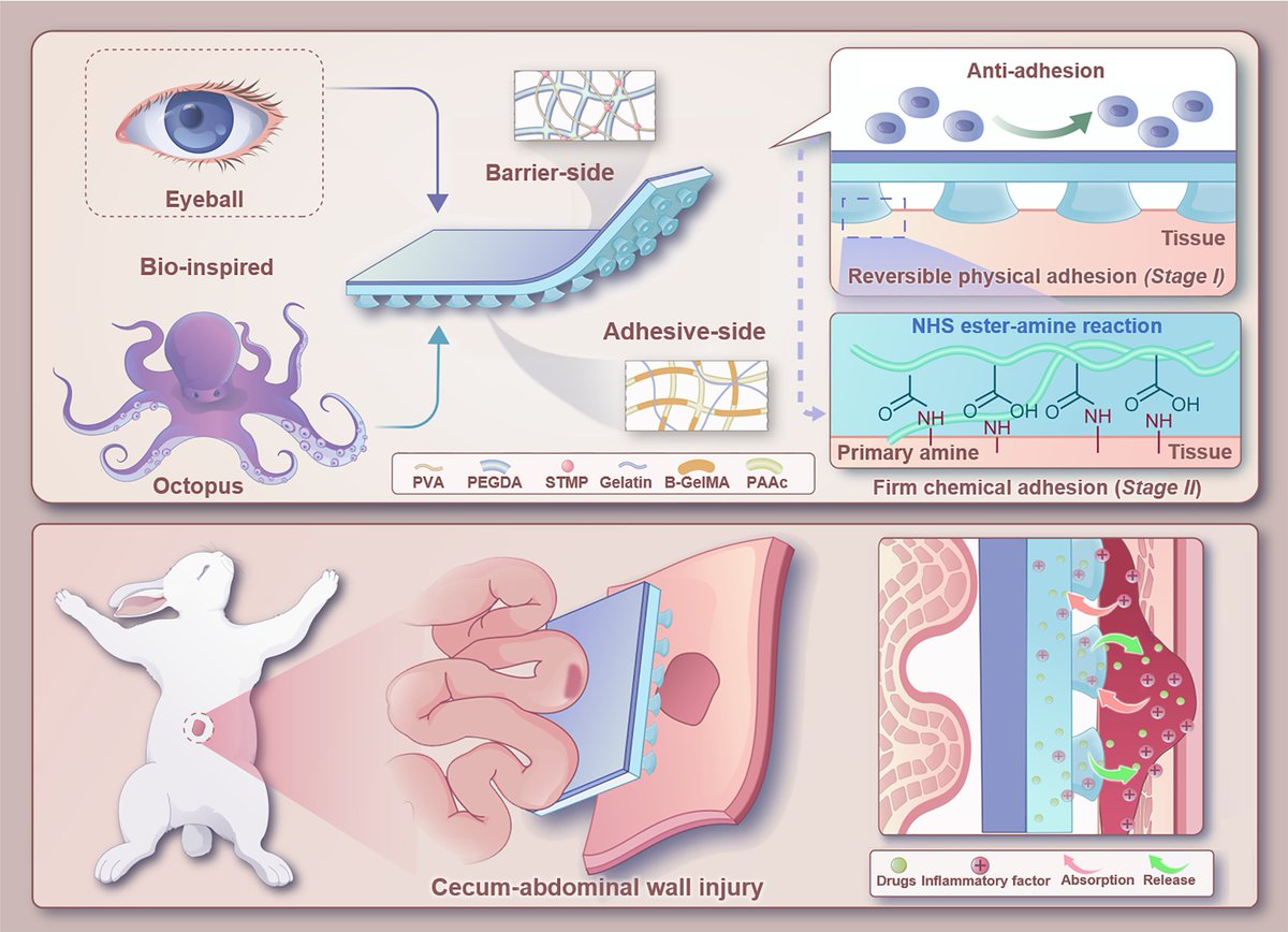 Torsten Brezesinski (@tbrezesinski) on Twitter photo New Paper out in #MaterialsFutures | "Bioinspired hydrogel patch with controllable adhesion for soft tissue repair" (Jian Cai, Lingyu Sun, Yu Wang & coworkers #SZU #UCAS <a href="/HongKongPolyU/">The Hong Kong Polytechnic University (PolyU)</a> #NJU) ➡️ doi.org/10.1088/2752-5….
<a href="/IOPPublishing/">IOP Publishing</a> <a href="/IOPmaterials/">IOPmaterials</a> #OpenAccess New Paper out in #MaterialsFutures | "Bioinspired hydrogel patch with controllable adhesion for soft tissue repair" (Jian Cai, Lingyu Sun, Yu Wang & coworkers #SZU #UCAS <a href="/HongKongPolyU/">The Hong Kong Polytechnic University (PolyU)</a> #NJU) ➡️ doi.org/10.1088/2752-5….
<a href="/IOPPublishing/">IOP Publishing</a> <a href="/IOPmaterials/">IOPmaterials</a> #OpenAccess