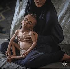 AmydSbh's tweet image. وضعیت غزه اونقدر دلخراش شده که بچهها از گرسنگی شدید نمیتونن گریه کنن و توی بغل خونواده هاشون جون میدن
و جهان با وحشت و ناامیدی این صحنه ها رو نگاه میکنه
#حب_الحسین_یجمعنا
#ملت_حسینی