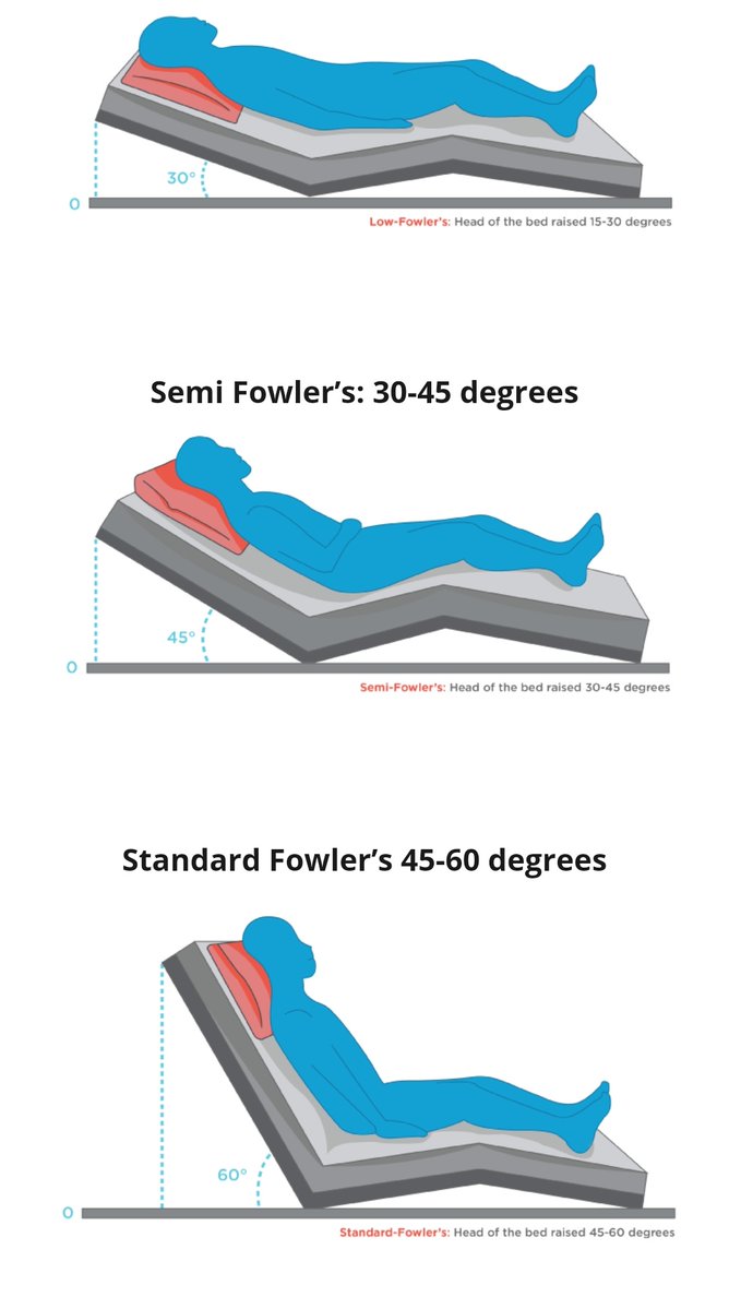 AlshammariOMFS's tweet image. وضعية فاولر (Fowler's position)
تعتبر الأنسب في حالة:
•إسعاف شخص مصاب في وجهه/فكيه
•بعد عمليات جراحة الفم والوجه والفكين
"...عند خروج المريض، ينصح مبدئياً بالنوم على أكثر من مخدة" مالم توجد موانع.