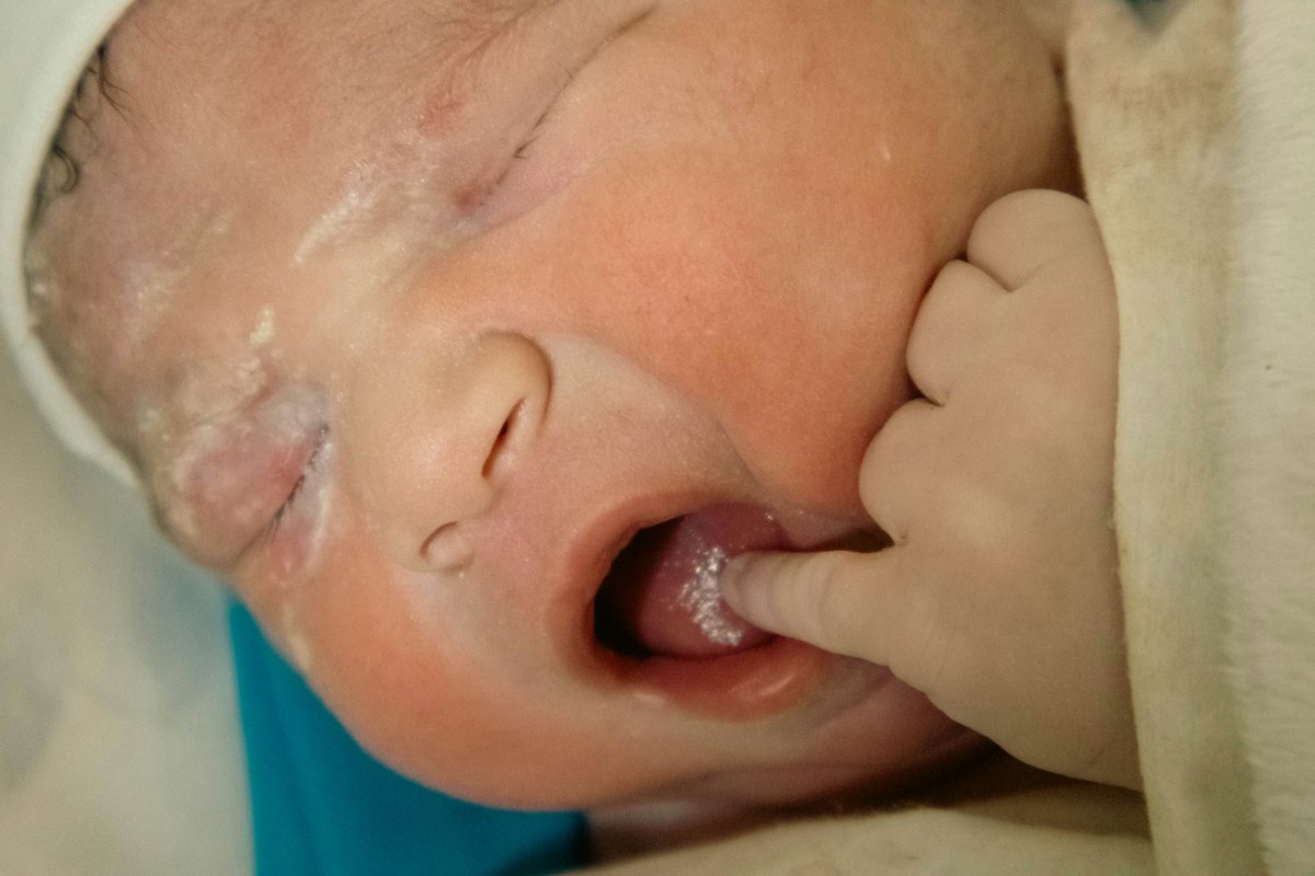 ArmageddonProse's tweet image. Fluoride ‘Tablets’ For Babies EXPLODE in Popularity Amid Water Fluoridation Rollbacks
armageddonprose.substack.com/p/fluoride-tab…