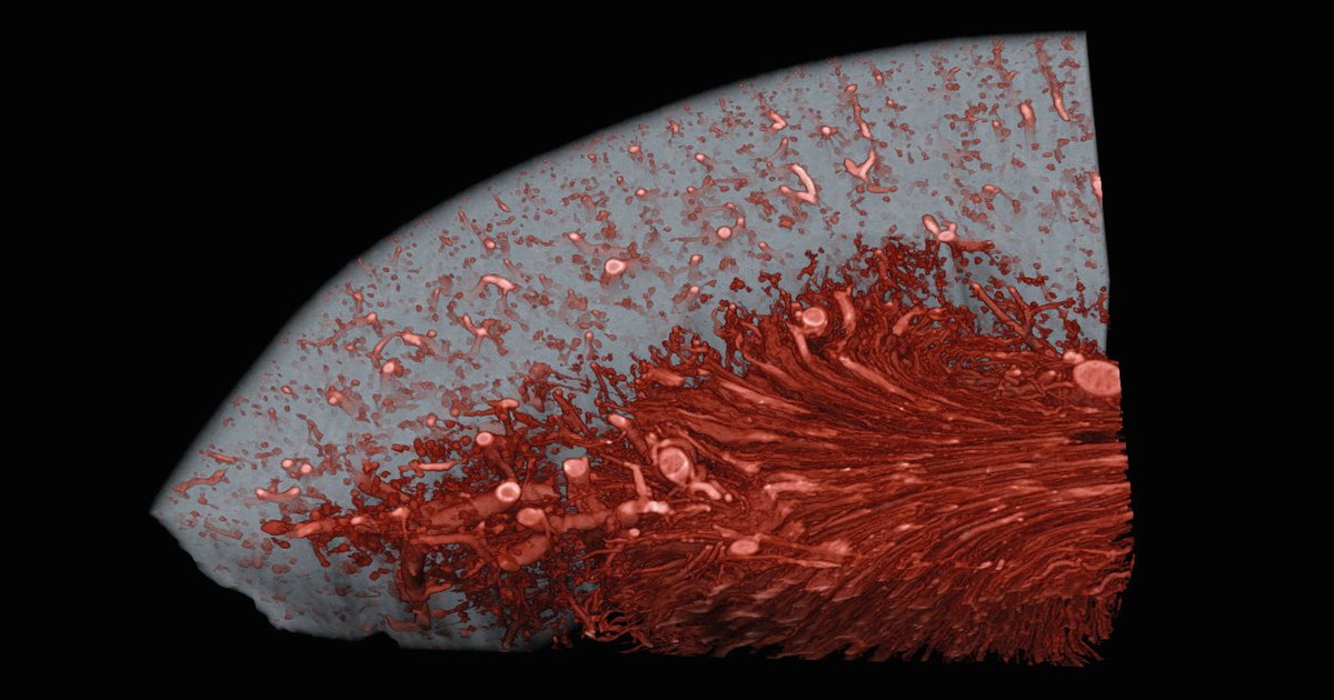 bruker's tweet image. The X4 POSEIDON system offers high-resolution imaging of kidney tissues, providing detailed insights into vascular structures and morphometry 🧬: goto.bruker.com/3TWjEP1
#KidneyResearch #BiomedicalResearch #MicroCT #X4POSEIDON #Innovation