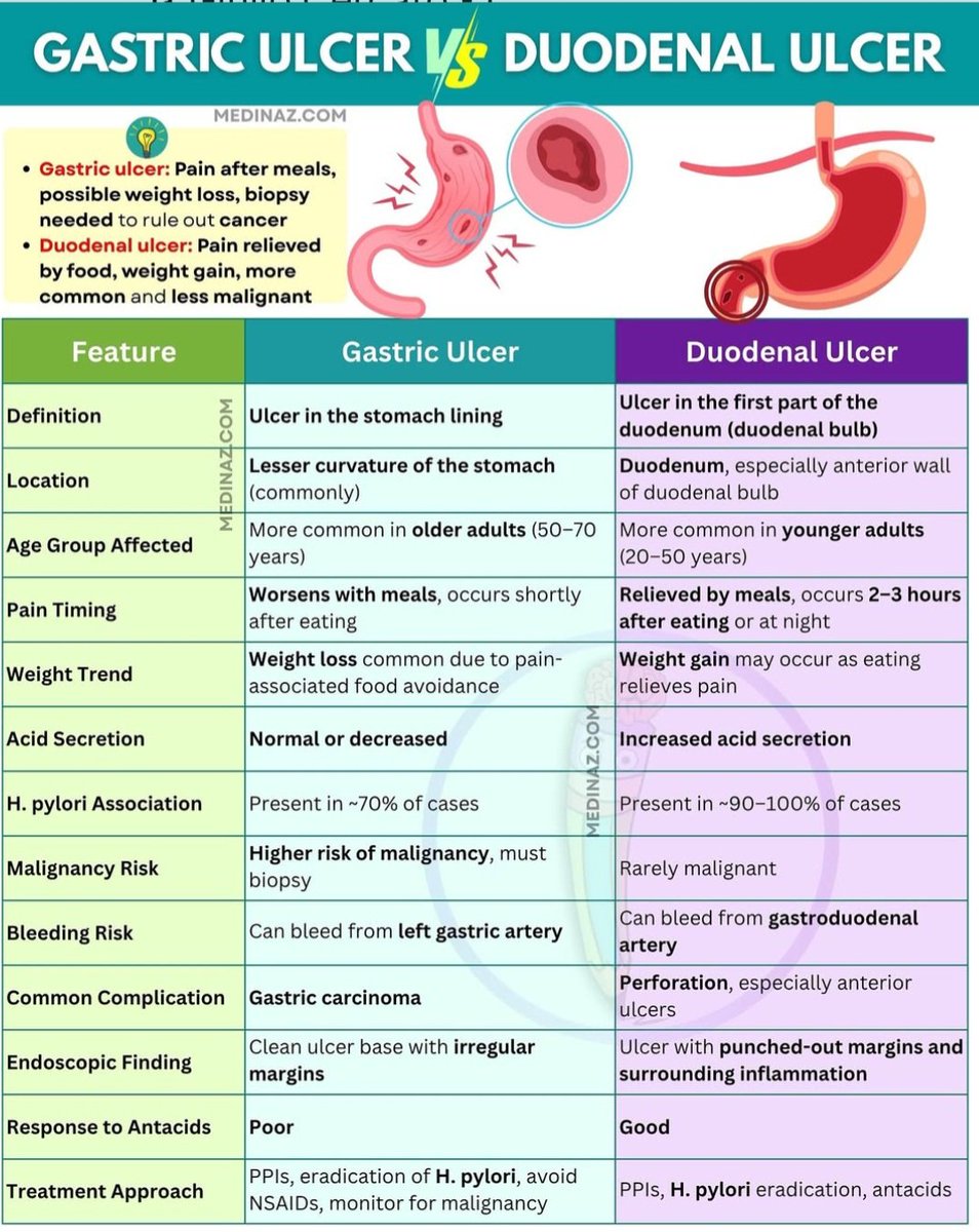 drsthanus's tweet image. A detailed comparison between Gastric Ulcers and Duodenal Ulcers, highlighting key differences in their features
instagram.com/p/DMfJ8BwMJi5