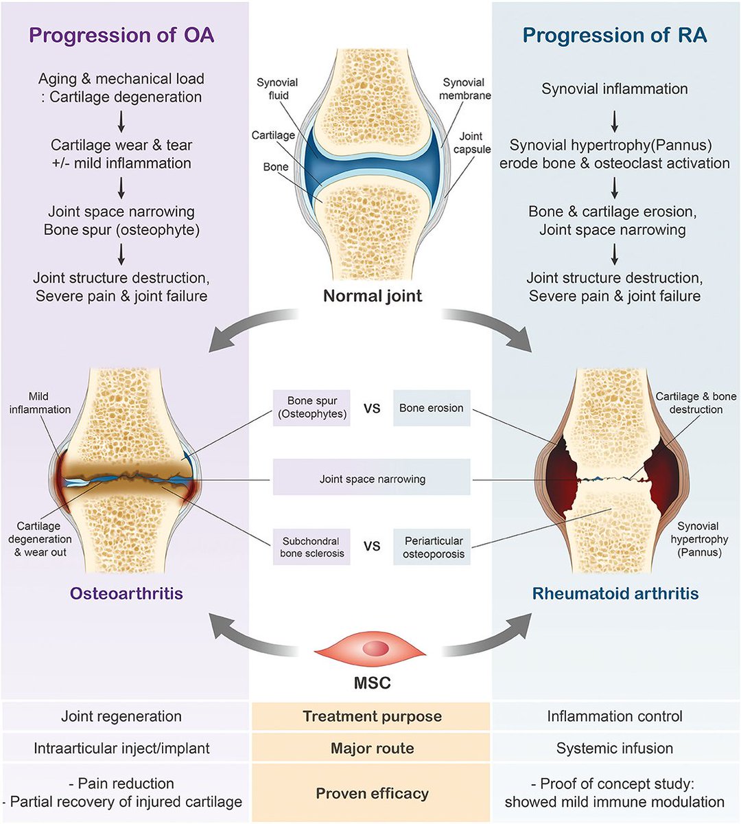 drsthanus's tweet image. Progression of rheumatoid arthritis (RA) and osteoarthritis (OA).
frontiersin.org/journals/immun…