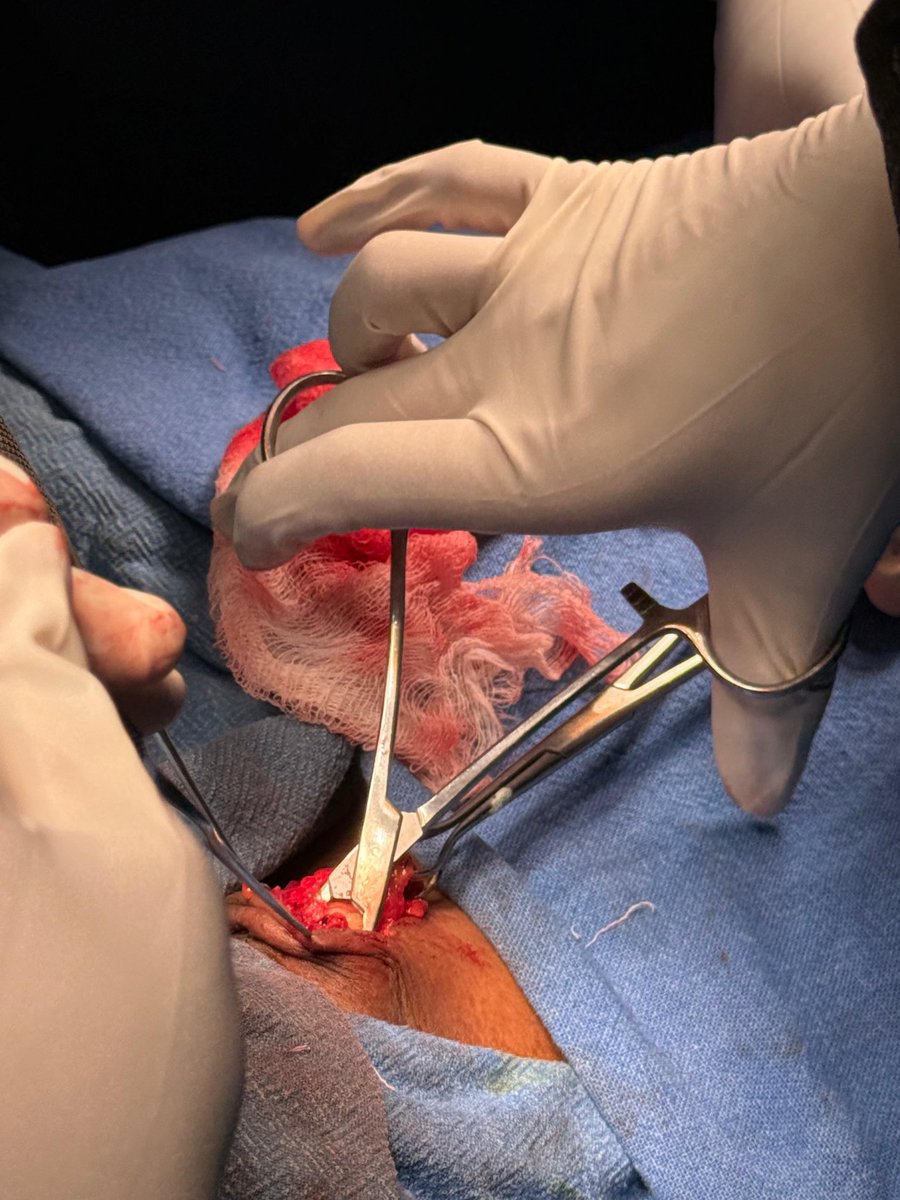 CodeSerotonin's tweet image. Oh how I love being a surgeon!