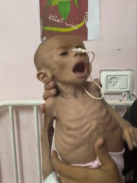 AsemaniHonar's tweet image. وضعیت ۱۷ هزار کودک در غزه💔...
چه قصه ی آشناییست؛
نوزاد و گرسنگی، تشنگی
بی رحمی حرمله ی زمان!
#حب_الحسین_یجمعنا
#ملت_حسینی