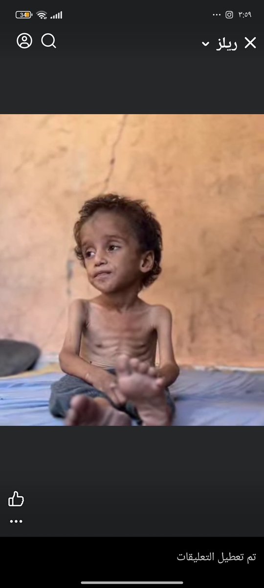 Asad10215's tweet image. We are starving.

Are you still with us ? Do you hear us !
If you see this pic, LEAVE a dot. spread it 💔🙏😭🙏🙏chuffed.org/project/138357
@8372momo @_kitslost @Anna_AnninaEl @BokinDonation @ZipSoSuperstar @zennoyed @c36FYf49xkIFXww @xoch7710 @0xJenWeb3 @fe2x02 @x_v_x_x_v_x