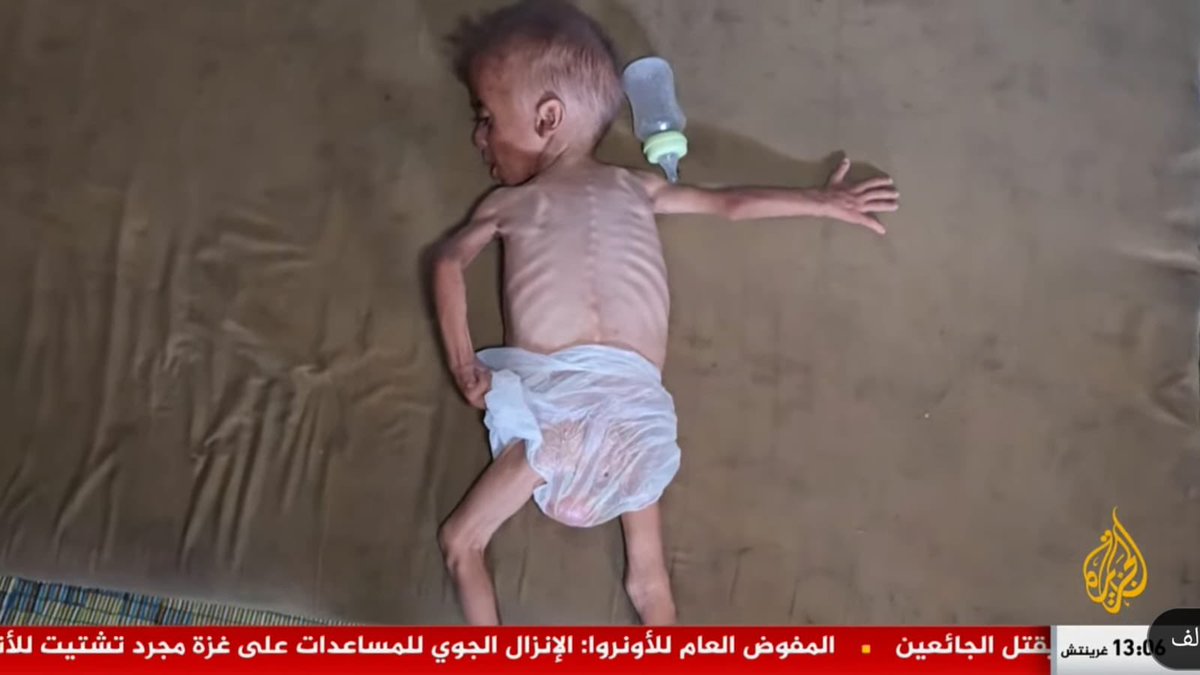 عبر تقريري على الجزيرة: صور صادمة من غزة تُظهر أطفالًا أنهكتهم المجاعة وسوء التغذية، وجوعًا قاتلًا وعطشًا يفتك بالنازحين، فيما يواصل الحصار الإسرائيلي سحق ما تبقى من الحياة في القطاع.