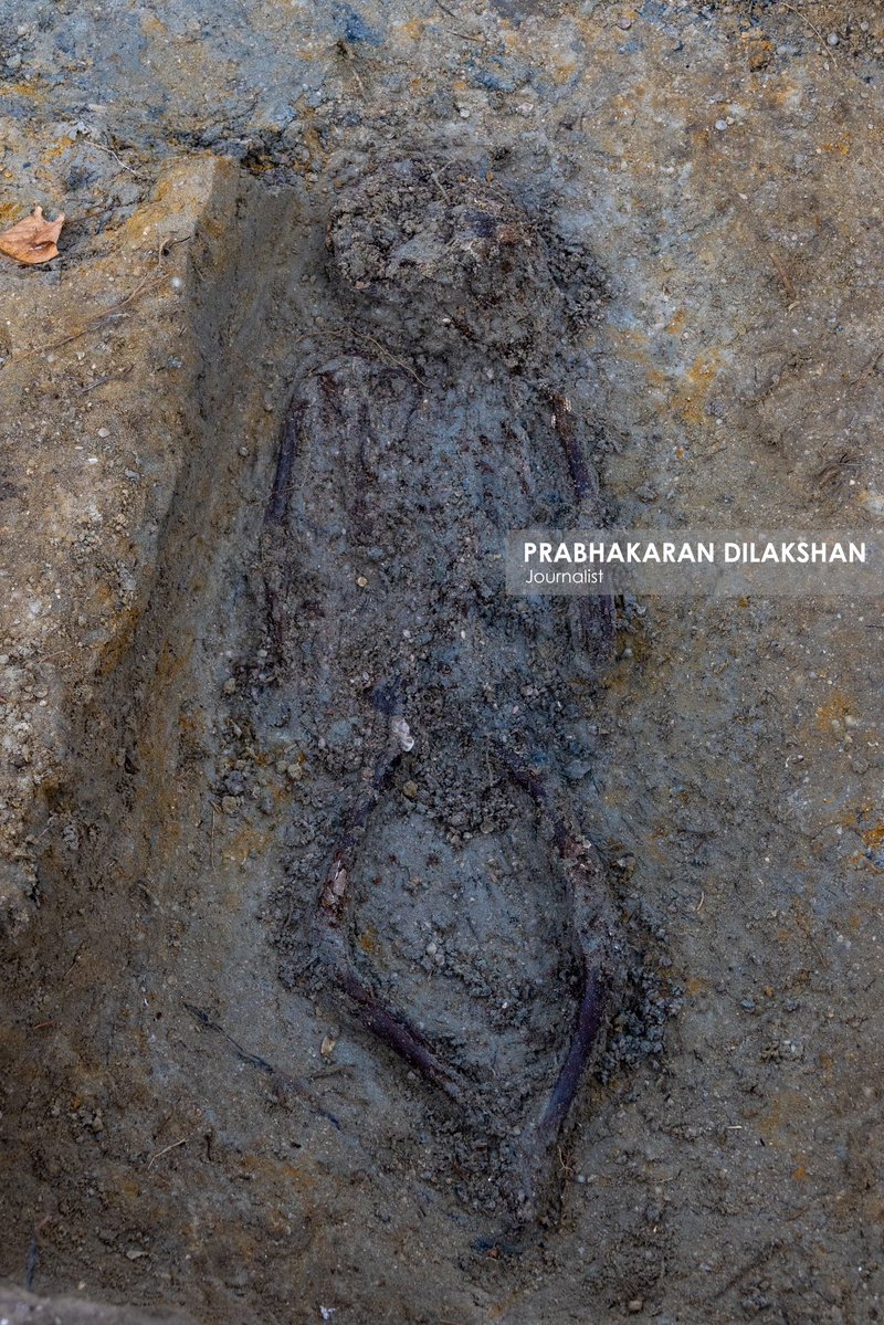 Prabhakaranlk's tweet image. யாழ்ப்பாணம் - செம்மணி மனிதப் புதைகுழியின் இன்றைய அகழ்வின் போது பதினொரு என்புத் தொகுதிகள் புதிதாக அடையாளம் காணப்பட்டுள்ளன.
செம்மணி மனிதப் புதைகுழியில் அடையாளம் காணப்பட்ட மனித என்புத் தொகுதிகளின் எண்ணிக்கை 101ஆக அதிகரித்துள்ளது.
90 என்புத் தொகுதிகள் அகழ்ந்தெடுக்கப்பட்டுள்ளன.