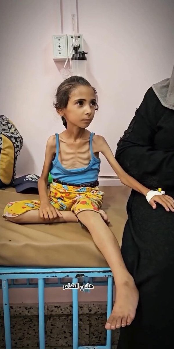UNRWA said that 200,000 Palestinian children are at risk in Gaza due to malnutrition and starvation.