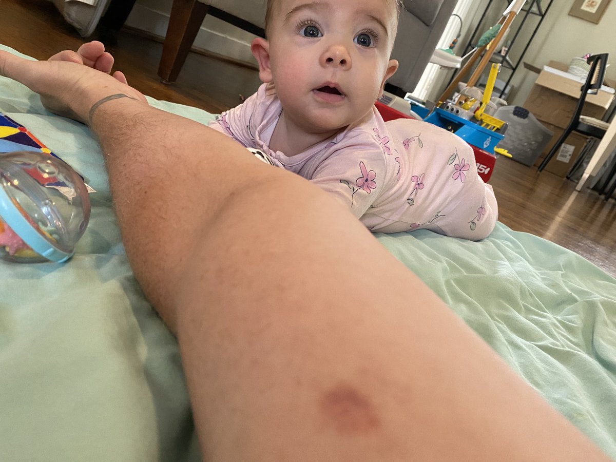 Got my first hickey today! My five month old daughter tried to breastfeed on my arm. Now it’s just awkward between us.