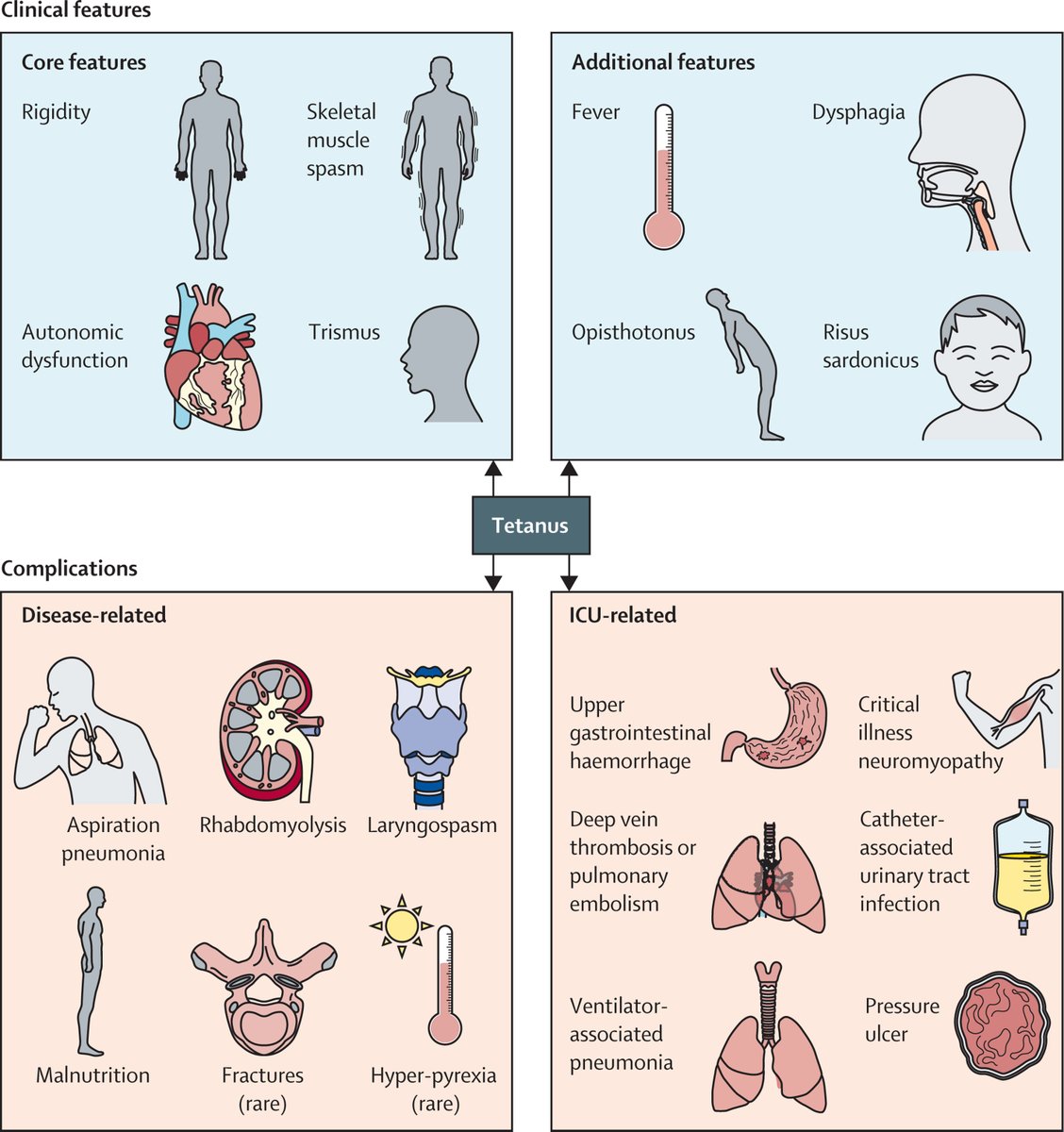 Tetanus is a devastating neurological infection that remains a major cause of global morbidity and mortality.

A new Review in <a href="/TheLancetInfDis/">The Lancet Infectious Diseases</a> provides a summary of the causes of tetanus, its clinical features, and management options. 

Find out more: hubs.li/Q03xHskq0
