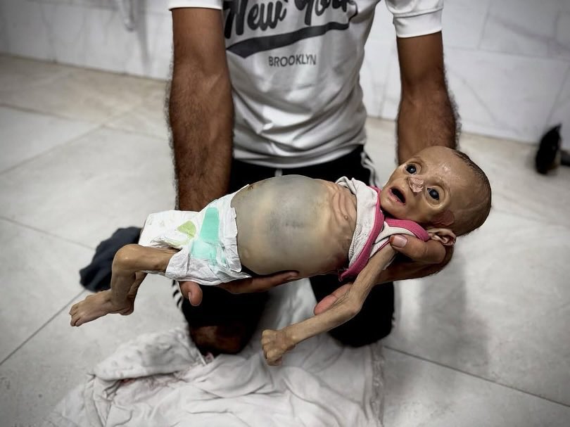 you’re scrolling, PLEASE leave a dot.

Pray for this little angel 💔🇵🇸