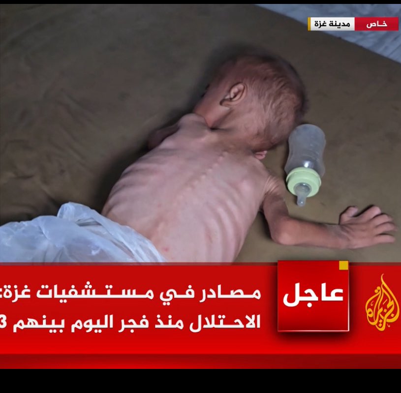 alihadi68's tweet image. Every day we see new horrific images of starved #Palestinian children in #Gaza it’s unbearable. This mother says she’s got nothing to give her child except water. Some may be lucky enough to add sugar to water! Multiple doctors who entered Gaza carrying baby formula had them…