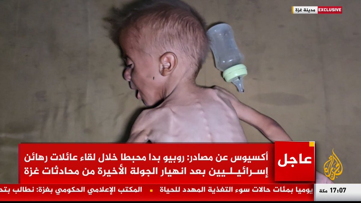 alihadi68's tweet image. Every day we see new horrific images of starved #Palestinian children in #Gaza it’s unbearable. This mother says she’s got nothing to give her child except water. Some may be lucky enough to add sugar to water! Multiple doctors who entered Gaza carrying baby formula had them…