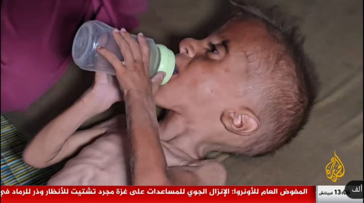 taleb_b72's tweet image. 🔴🔴🔴🔴Shocking images from Gaza show children exhausted by starvation and malnutrition, deadly hunger and thirst that is killing the displaced, as the Israeli blockade continues to crush what remains of life in the Strip.