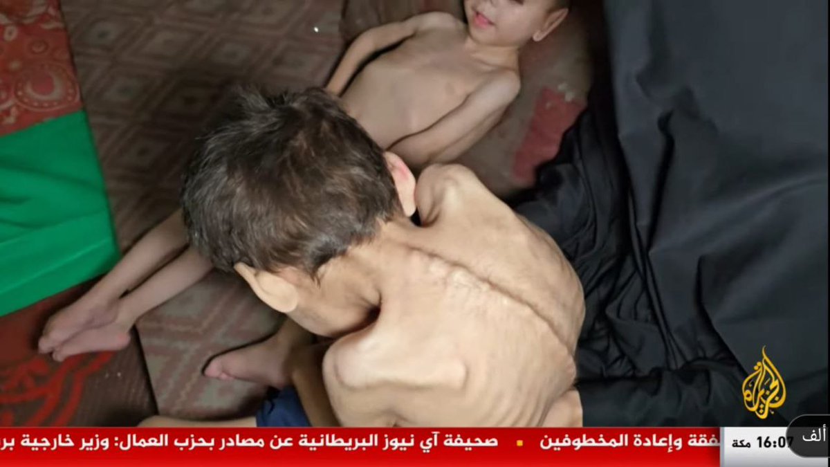 taleb_b72's tweet image. 🔴🔴🔴🔴Shocking images from Gaza show children exhausted by starvation and malnutrition, deadly hunger and thirst that is killing the displaced, as the Israeli blockade continues to crush what remains of life in the Strip.