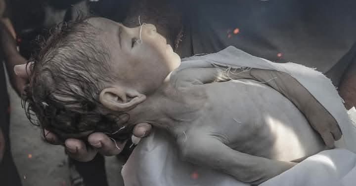 صرف آج کے دن 76بچے بھوک  کی وجہ سے شہید ہوئے💔