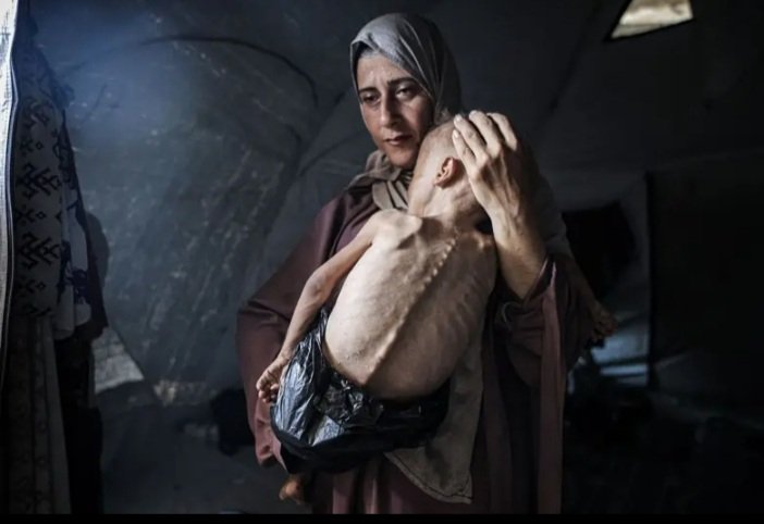 Faixa de Gaza, julho de 2025.

Fome, morte, extermínio, genocídio.

Quem cala consente.

* Foto de Ahmed al-Arini (Anadolu/Getty Images)