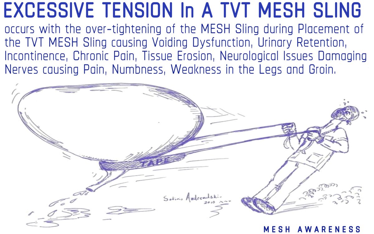 JanUrban12's tweet image. USA - Reports by Doctors of these Mesh Complications were known by the Mesh Makers which surfaced in or around 2009 during discovery were never made public. It was often 'Flagged' by the Defense Attorney's in suits filed against the Mesh Makers. Mesh Crisis.