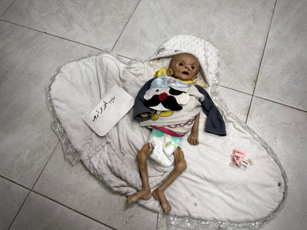 Another 5 kids died of starvation today in Gaza.