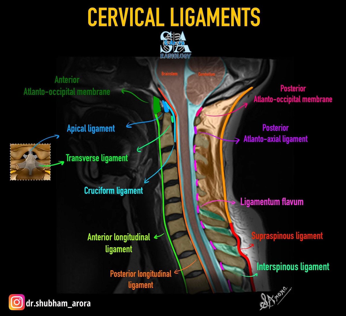 MoAImam's tweet image. Cervical spine ligaments