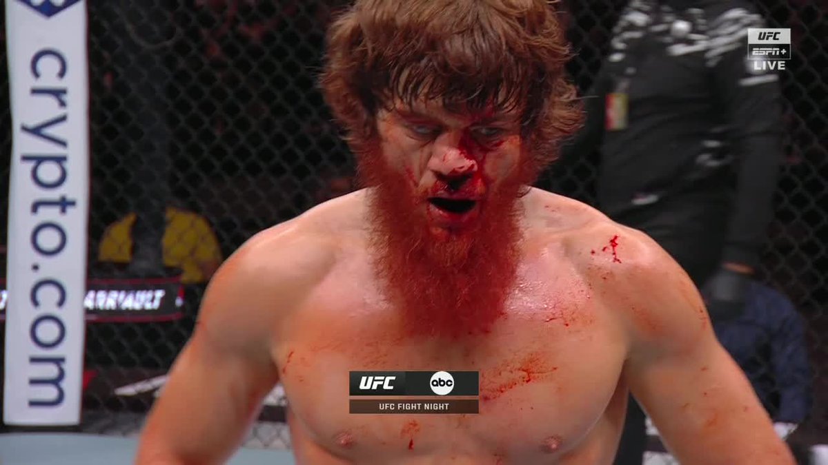 Shara's nose after the second round 🤯 #UFCAbuDhabi