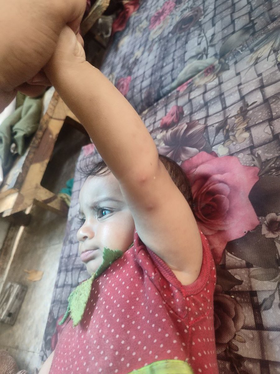Are you looking at my daughter Agalia's condition?Please look closely at the picture.There are pimples due to lack of proper nutrition,and her mother needs good food.Please help me support andspread my campaign to buy diapers and formula milk. chuffed.org/project/135074…
<a href="/oliveegirl/">Olive 🌿</a>