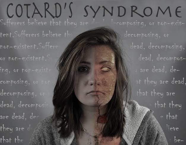 learnpool_fun's tweet image. Imagine believing you're already dead...

That your organs are rotting.
That you have no blood.
That your soul has left your body.

This isn’t a horror film, it’s a real condition so rare, most doctors never see it.

It’s called Cotard’s Delusion 🧵👇