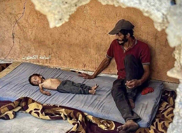 #HungerIsnotAWeapon

Buna göz yuman, kılını kıpırdatmayan, sadece sözde kalan tüm Müslüman ülke yöneticilerinden beriyiz bizi onlarla hesaba çekme Allah'ım!