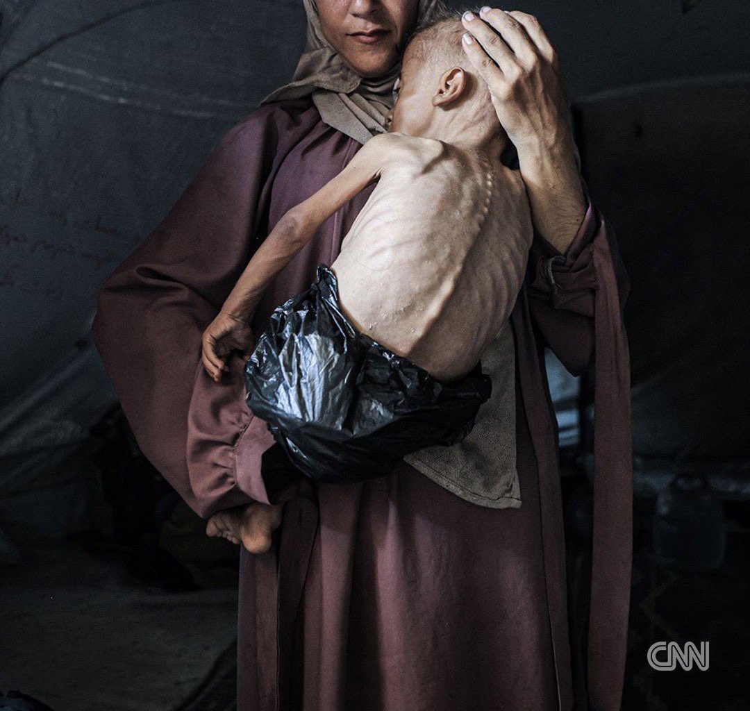 ahmed9064963's tweet image. The price of a bag of flour is $1000. ๐๐ป๐ต๐ธ๐๐จ๐ฆ
25 kg
chuffed.org/project/126845