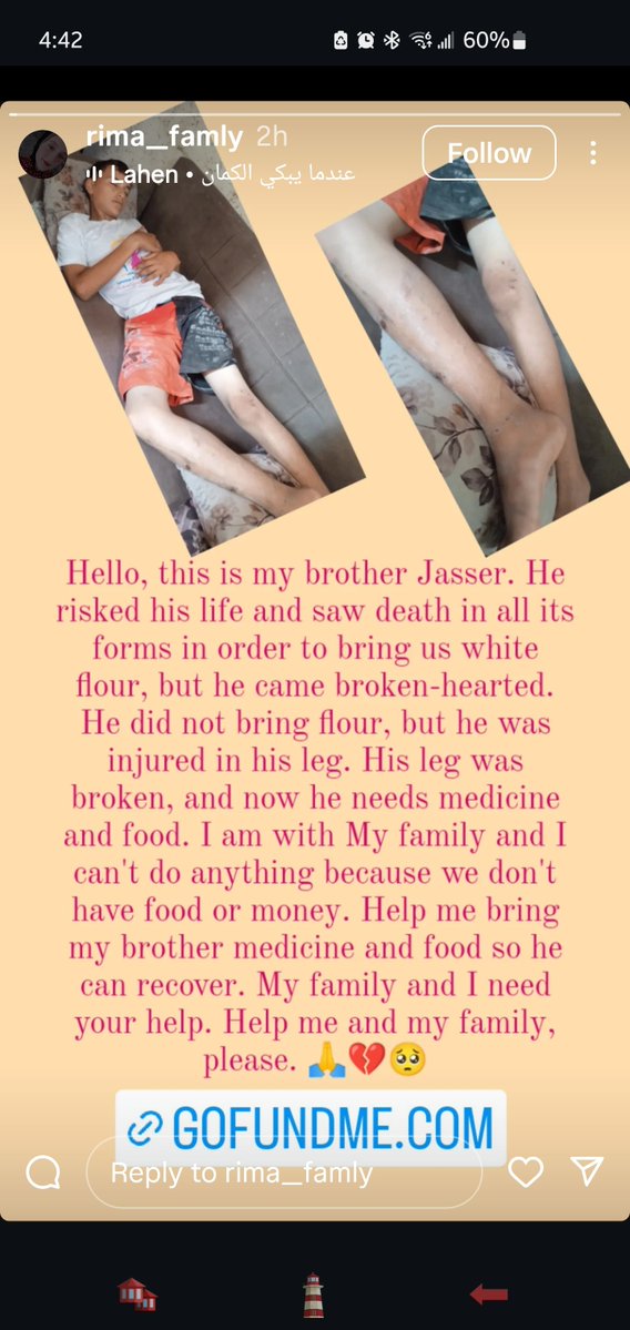 OnASilverPlaty's tweet image. ❗️❗️URGENT UPDATE❗️❗️
Reema's younger brother needs LIFE SAVING medical assistance now
Please do not hesitate to d0nate and share this post 🇵🇸❗️❗️
gofund.me/52255608