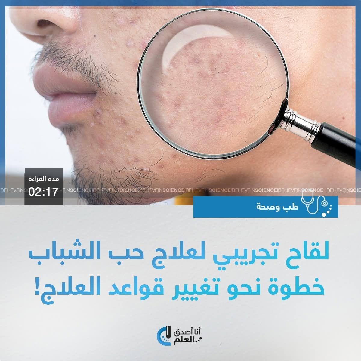 IBelieveInSci's tweet image. قد يشكل اللقاح التجريبي الجديد بارقة أمل في إحداث تحول مستقبلي في علاج حب الشباب، بحسب ما أفادت به الشركة المطورة، إلا أن الأبحاث لا تزال في مراحلها الأولى.
التفاصيل على الرابط التالي:
ibelieveinsci.com/kmf8