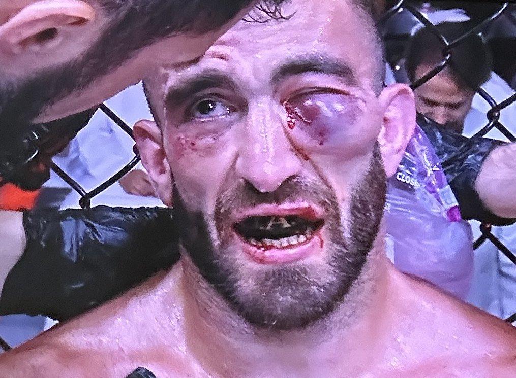 SaturdayNiteMMA's tweet image. Jesus Christ #UFCAbuDhabi