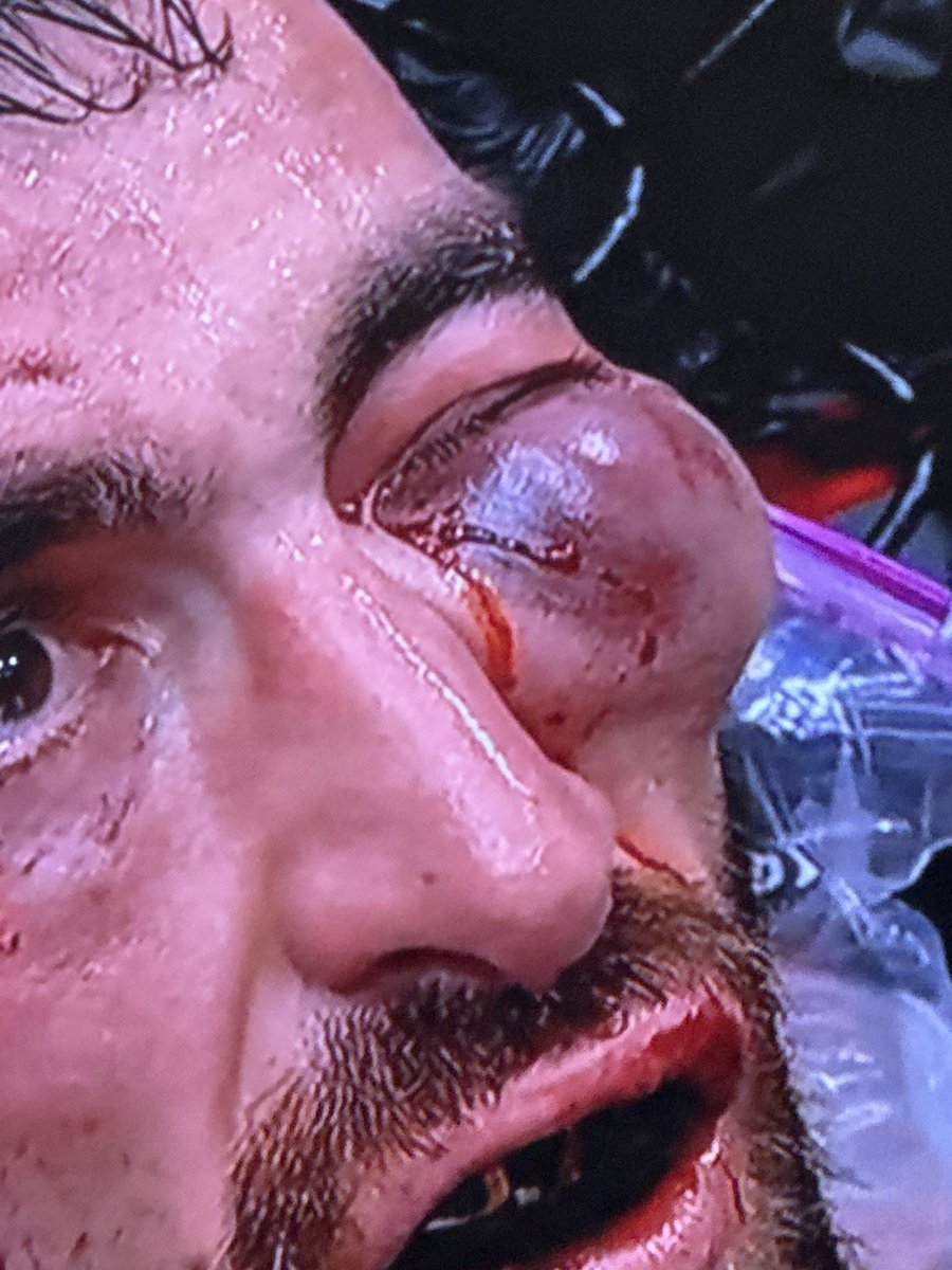 trillobets's tweet image. Happy Saturday #UFCAbuDhabi
