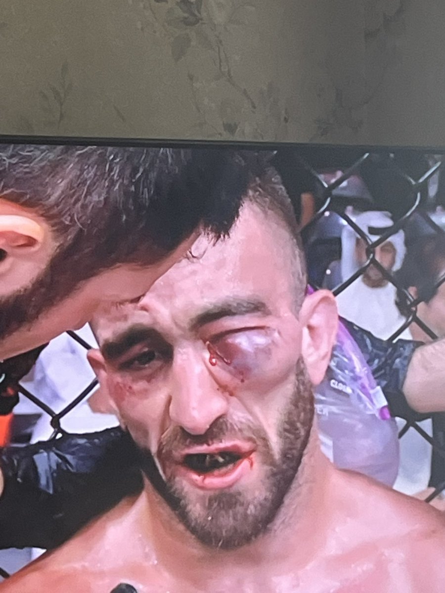 Le5emeRound's tweet image. #UFCAbuDhabi #UFC